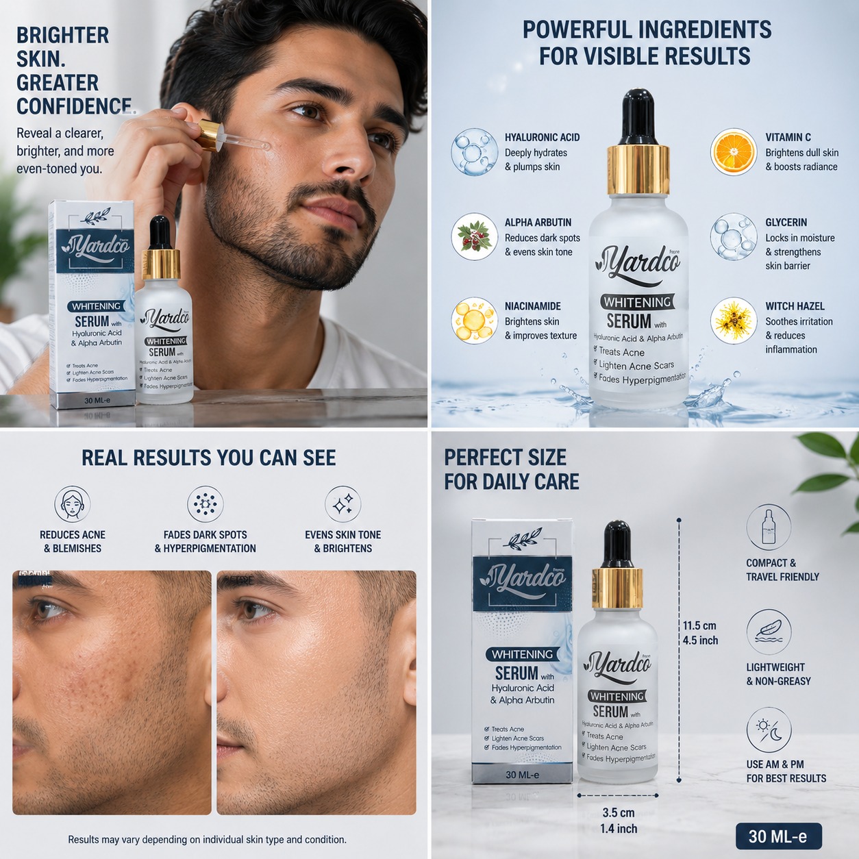 Yardco Whitening Serum With Hyaluronic Acid And Alpha Arbutin Anti Acne And Dark Spot Corrector For Men 30ml - Image 2