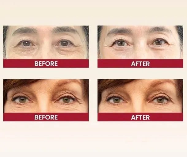 K-SECRET SEOUL 1988 Eye Cream: Retinal Liposome 2% + Fermented Black Bean – Advanced Anti-Aging & Brightening Formula - 30ml - Image 3